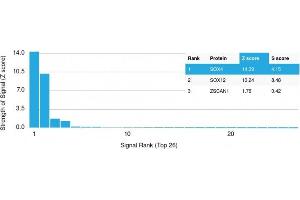 Analysis of Protein Array containing more than 19,000 full-length human proteins using SOX4 Mouse Monoclonal Antibody (SOX4/2540).