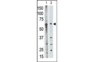 Image no. 1 for anti-Matrix Metallopeptidase 25 (MMP25) (C-Term) antibody (ABIN358695) (MMP25 antibody  (C-Term))