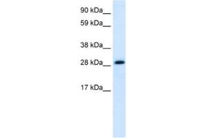 Western Blotting (WB) image for anti-Activator of Basal Transcription 1 (Abt1) antibody (ABIN2460512)