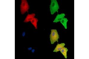 ABIN7096116 and ABIN7100178 staining  cells by IF/ICC.