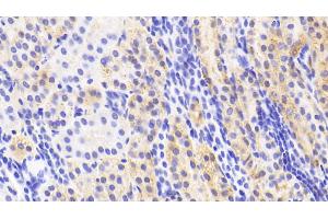 Detection of NAGa in Human Kidney Tissue using Polyclonal Antibody to N-Acetylgalactosaminidase Alpha (NAGa) (NAGA antibody  (AA 18-217))