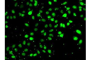 Immunofluorescence analysis of HeLa cell using NUDT2 antibody. (NUDT2 antibody)