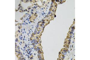 Immunohistochemistry of paraffin-embedded mouse lung using DNM2 antibody (ABIN5970189) (40x lens).