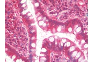 Anti-TCL / RHOJ antibody IHC staining of human small intestine. (RHOJ antibody)