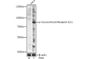 Western blot analysis of extracts of HeLa cells, using Phospho-Glucocorticoid Receptor-S211 antibody (ABIN6135269, ABIN6136160, ABIN6136161 and ABIN6225653) at 1:2000 dilution. (Glucocorticoid Receptor antibody  (pSer211))