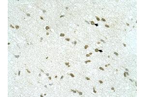 RNF168 antibody was used for immunohistochemistry at a concentration of 4-8 ug/ml to stain Neural cells (arrows) in Human Brain. (RNF168 antibody  (C-Term))