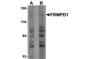 Western blot analysis of FRMPD1 in K562 cell lysate with AP30347PU-N FRMPD1 antibody at (A) 1 and (B) 2 μg/ml.