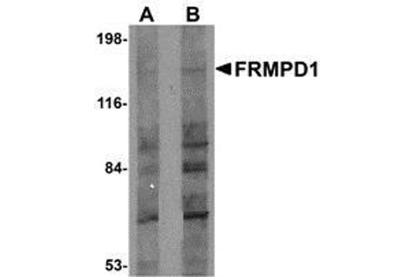 FRMPD1 antibody  (C-Term)