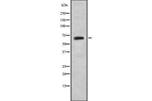 Western blot analysis of TBX15/18 using HepG2 whole cell lysates (T-Box 15/18 antibody)