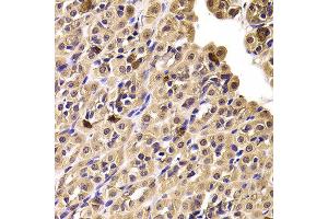 Immunohistochemistry of paraffin-embedded Rat stomach using CCT4 antibody at dilution of 1:100 (x400 lens). (CCT4 antibody)