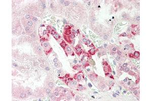 CUTA antibody  (AA 71-120)