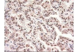 Image no. 9 for anti-Myc Proto-Oncogene protein (MYC) antibody (ABIN1497013) (c-MYC antibody)