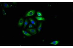 Immunofluorescence staining of A549 cells with ABIN7173891 at 1:400, counter-stained with DAPI. (FAS antibody  (AA 26-171))