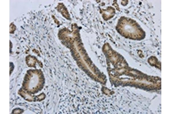 MMP24 antibody