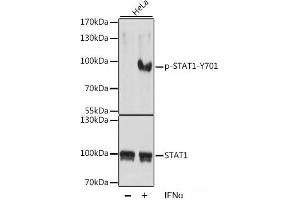 Western blot analysis of extracts of HeLa cells using Phospho-STAT1(Y701) Polyclonal Antibody at dilution of 1:1000. (STAT1 antibody  (pTyr701))