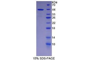 SDS-PAGE analysis of Human NFkB2 Protein. (Nuclear Factor kappa B2 Protein)