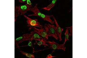 Immunofluorescence analysis of U251 cells using OTX2 monoclonal antobody, clone 1H12G8B2  (green).