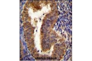 NIX Antibody (Center) (ABIN655731 and ABIN2845178) immunohistochemistry analysis in formalin fixed and paraffin embedded human uterus tissue followed by peroxidase conjugation of the secondary antibody and DAB staining. (BNIP3L/NIX antibody  (AA 52-81))