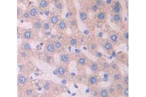 Used in DAB staining on fromalin fixed paraffin- embedded Kidney tissue (Surfactant Protein C antibody  (AA 95-194))