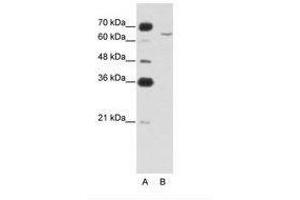 Image no. 1 for anti-Cytoplasmic Polyadenylation Element Binding Protein 2 (CPEB2) (AA 543-592) antibody (ABIN6749718) (CPEB2 antibody  (AA 543-592))