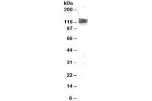 Western blot testing of NIH3T3 lysate with CBL antibody at 2ug/ml. (CBL antibody)