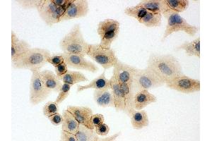 Anti- SLC2A1 Picoband antibody, ICC ICC: A549 Cell (GLUT1 antibody  (AA 92-492))