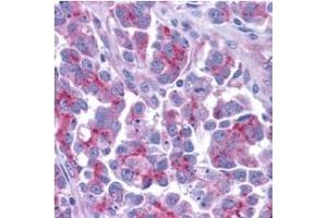 Smac/DIABLO â€“ ABIN121595 staining of human ovary tissue with anti-Smac/DIABLO (CT) at 5 (DIABLO antibody  (AA 225-239))