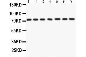 Anti- Lamin A Picoband antibody, Western blottingAll lanes: Anti Lamin A  at 0. (Lamin A/C antibody  (AA 481-646))