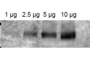 Image no. 1 for anti-ATP-Binding Cassette, Sub-Family B (MDR/TAP), Member 1 (ABCB1) (AA 262-277) antibody (ABIN401371) (ABCB1 antibody  (AA 262-277))