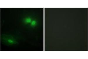 Immunofluorescence analysis of HeLa cells, using DAXX Antibody. (DAXX antibody  (AA 361-410))