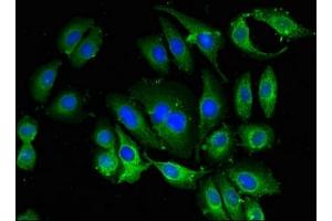 Immunofluorescent analysis of A549 cells using ABIN7145258 at dilution of 1:100 and Alexa Fluor 488-congugated AffiniPure Goat Anti-Rabbit IgG(H+L) (BANF1 antibody  (AA 2-89))