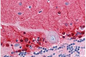 Human Brain, Cerebellum (formalin-fixed, paraffin-embedded) stained with AMPH antibody ABIN351482 at 2. (Amphiphysin antibody  (AA 159-170))