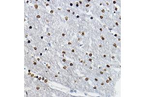 Immunohistochemistry of paraffin-embedded rat brain using SOX10 Rabbit pAb (ABIN6134484, ABIN6148289 and ABIN7101829) at dilution of 1:100 (40x lens). (SOX10 antibody)