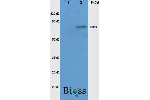Lane 1: Mouse Liver, lysates Lane 2: Mouse Brain probed with Rabbit Anti-c-Raf(Ser338/Tyr340) Polyclonal Antibody, Unconjugated  at 1:3000 for 90 min at 37˚C. (RAF1 antibody  (pSer338, pTyr340))
