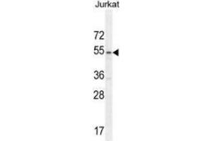 Western blot analysis in Jurkat cell line lysates (35ug/lane) using MPP1 Antibody .