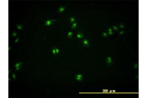 Immunofluorescence of monoclonal antibody to TARDBP on HeLa cell. (TARDBP antibody  (AA 1-260))