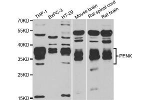 Western blot analysis of extracts of various cell lines, using PENK antibody (ABIN5973724) at 1/1000 dilution. (Enkephalin antibody)