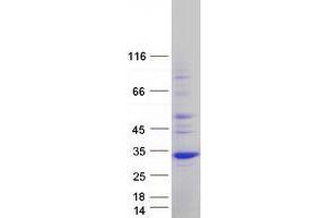 Validation with Western Blot (UNC119 Protein (Transcript Variant 2) (Myc-DYKDDDDK Tag))