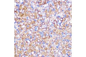 Immunohistochemistry of paraffin-embedded Rat ovary using NEK9 antibody (ABIN7268914) at dilution of 1:100 (40x lens). (NEK9 antibody  (AA 730-979))