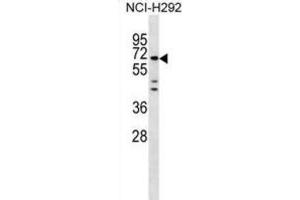 Western Blotting (WB) image for anti-Mesoderm Induction Early Response 1, Family Member 3 (MIER3) antibody (ABIN3000205)