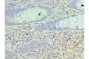 Immunohistochemistry of paraffin-embedded human epityphlon tissue using ABIN7162980 at dilution of 1:100 (HSD17B4 antibody  (AA 437-736))