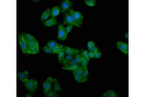 Immunofluorescence staining of HepG2 cells with ABIN7154621 at 1:100, counter-stained with DAPI.