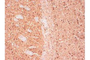 CASK Immunohistochemistry. (CASK antibody)
