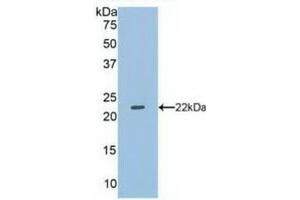 Detection of Recombinant DUSP3, Human using Polyclonal Antibody to Dual Specificity Phosphatase 3 (DUSP3) (Dual Specificity Phosphatase 3 (DUSP3) (AA 2-185) antibody)
