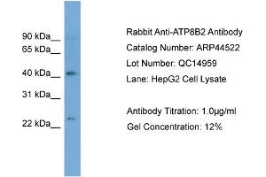 WB Suggested Anti-ATP8B2  Antibody Titration: 0. (ATP8B2 antibody  (N-Term))