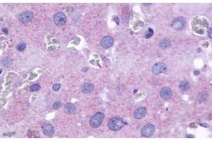 Immunohistochemical (Formalin/PFA-fixed paraffin-embedded sections) staining in human ovary with PTGFR polyclonal antibody . (PTGFR antibody  (2nd Cytoplasmic Domain))