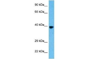 Host:  Rat  Target Name:  FOS  Sample Tissue:  Rat Liver  Antibody Dilution:  1ug/ml (c-FOS antibody  (C-Term))