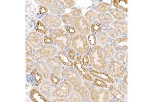 Immunohistochemistry of paraffin-embedded mouse kidney using KRAS Rabbit pAb (ABIN3021676, ABIN3021677, ABIN3021678, ABIN1513137 and ABIN1514282) at dilution of 1:150 (40x lens). (K-RAS antibody)