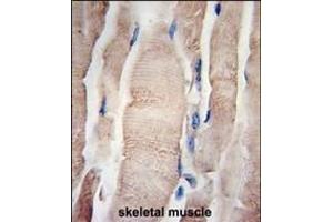 Formalin-fixed and paraffin-embedded human skeletal muscle tissue reacted with PHPT1 Antibody (N-term) (ABIN389182 and ABIN2839345) , which was peroxidase-conjugated to the secondary antibody, followed by DAB staining. (PHPT1 antibody  (C-Term))