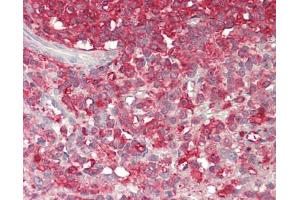 Immunohistochemistry (Paraffin-embedded Sections) (IHC (p)) image for anti-Proprotein Convertase Subtilisin/kexin Type 9 (PCSK9) (AA 454-679) antibody (Biotin) (ABIN2626615)